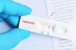 Legionella: cos'è, prevenzione e analisi